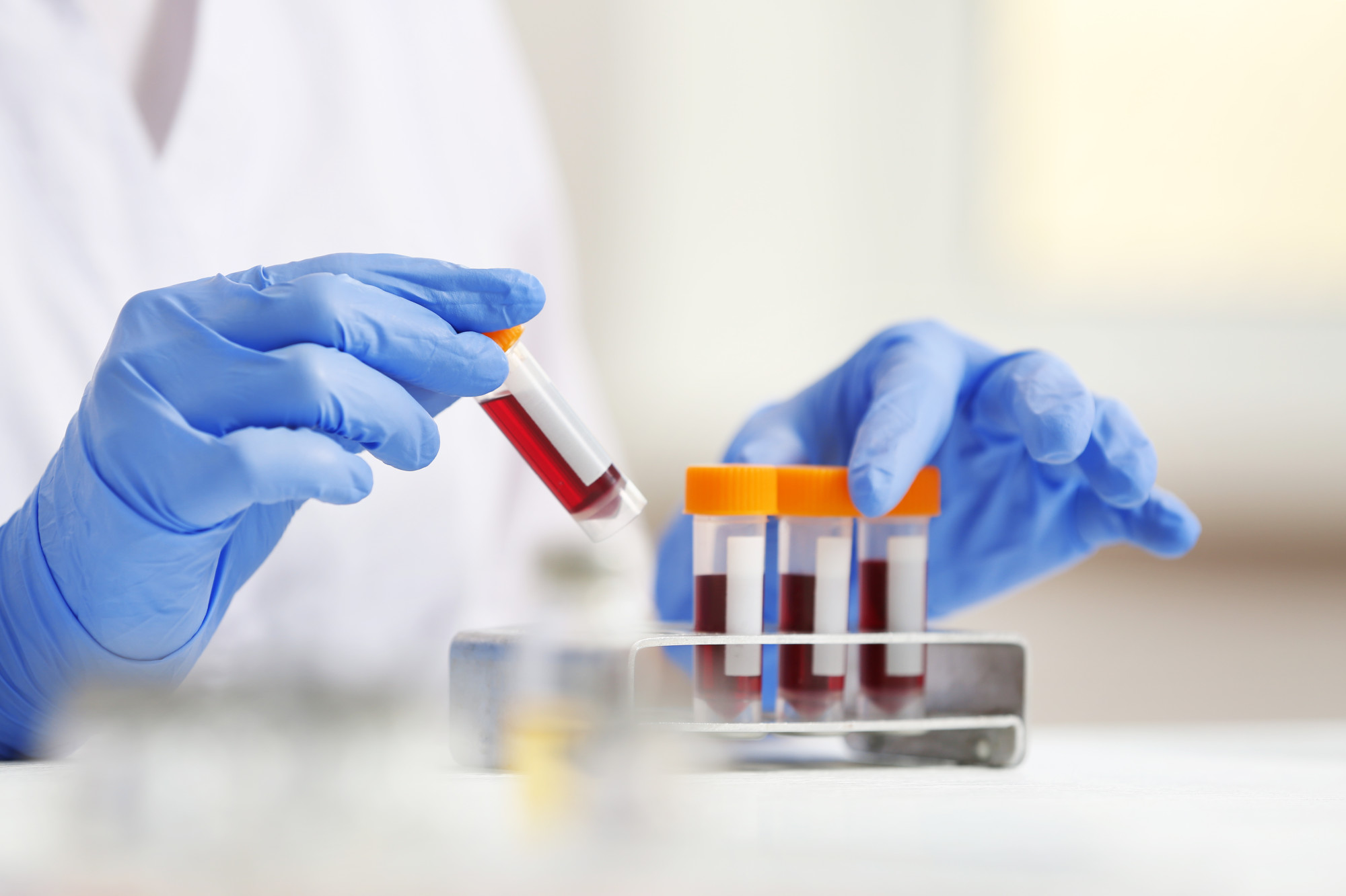 online analysis of blood test