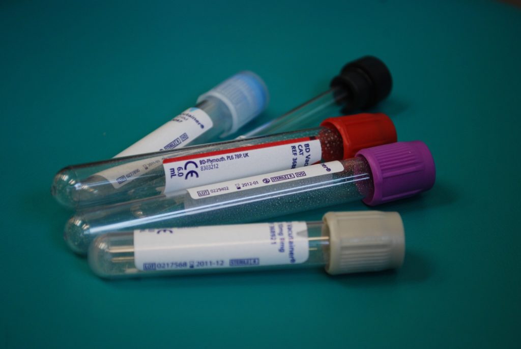 How to Understand Your Blood Test Results