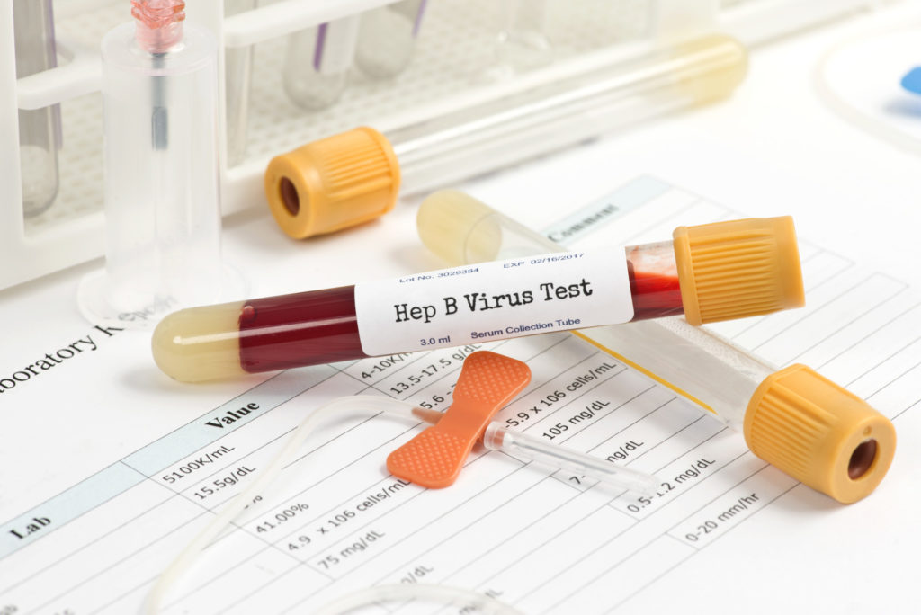 What Can You Detect From a Blood Test?