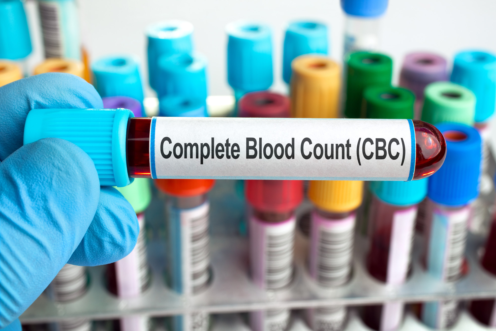 cbc-test-complete-blood-count-cbc-test-results-normal-complete