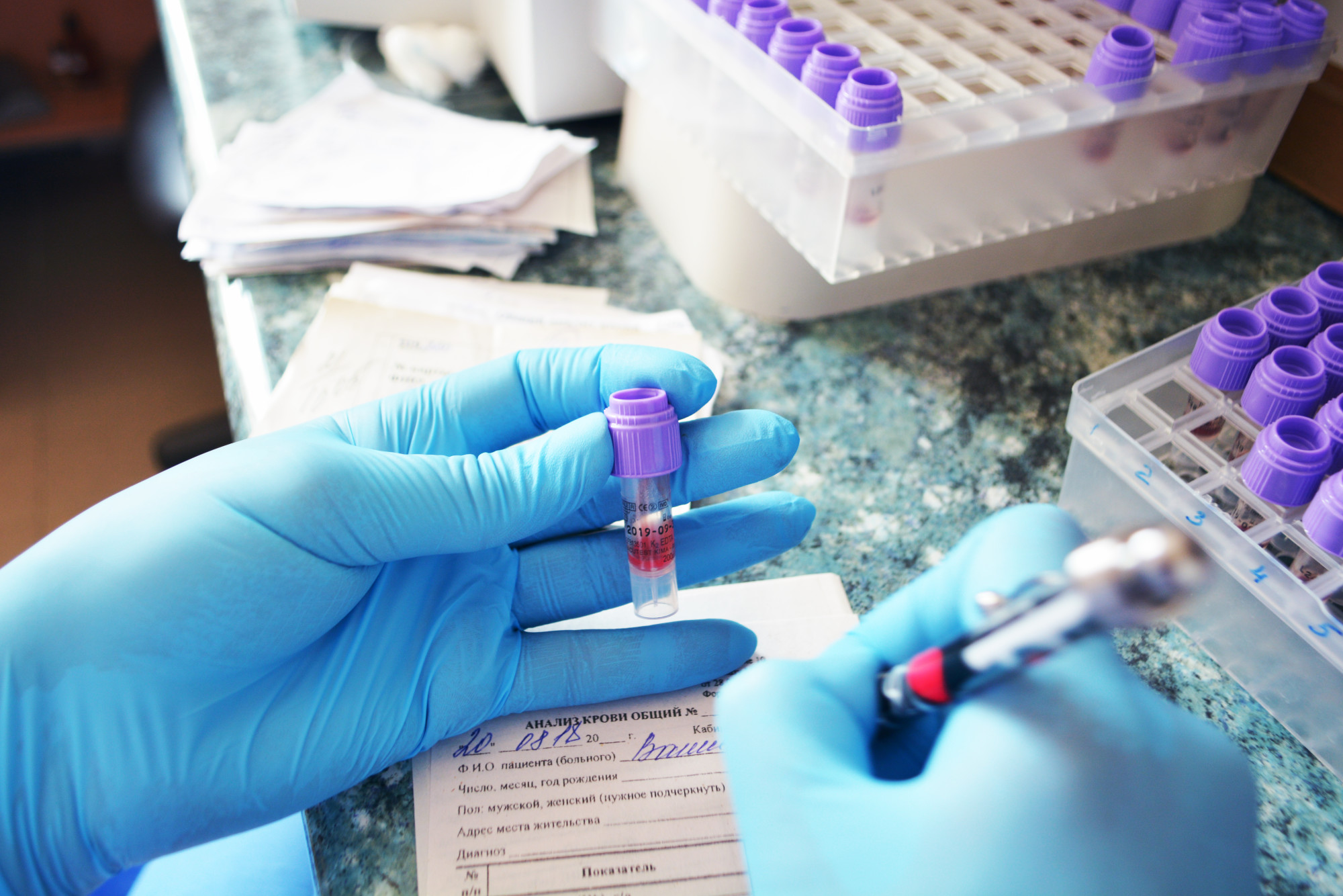 What Is A Cmp Blood Test Looking For