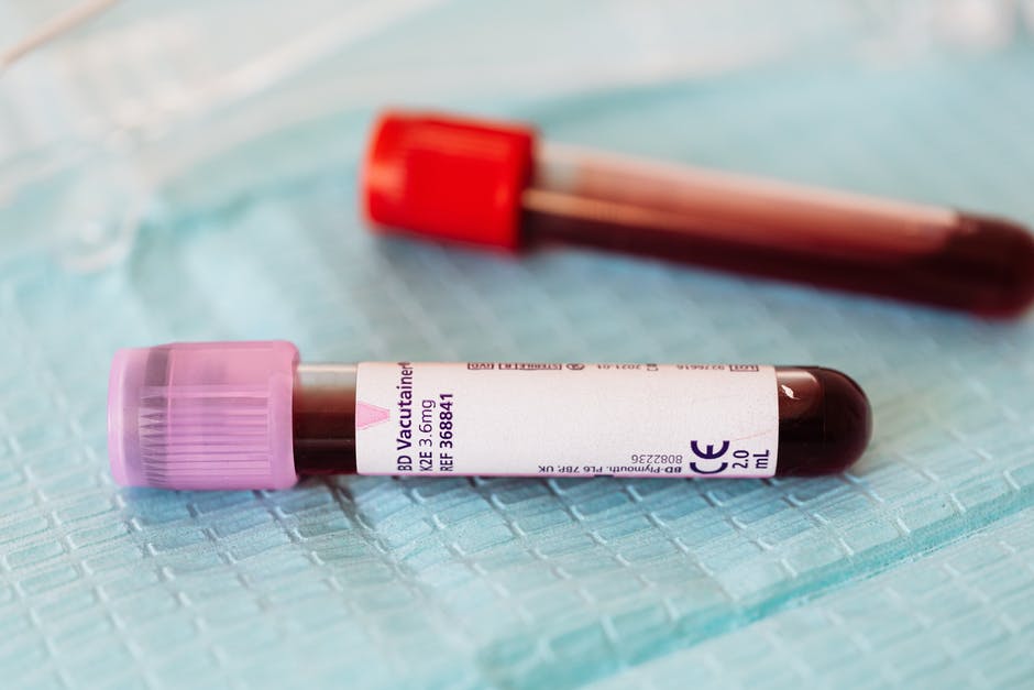 The Blood Type Lab Test How Does It Work Precision Labs