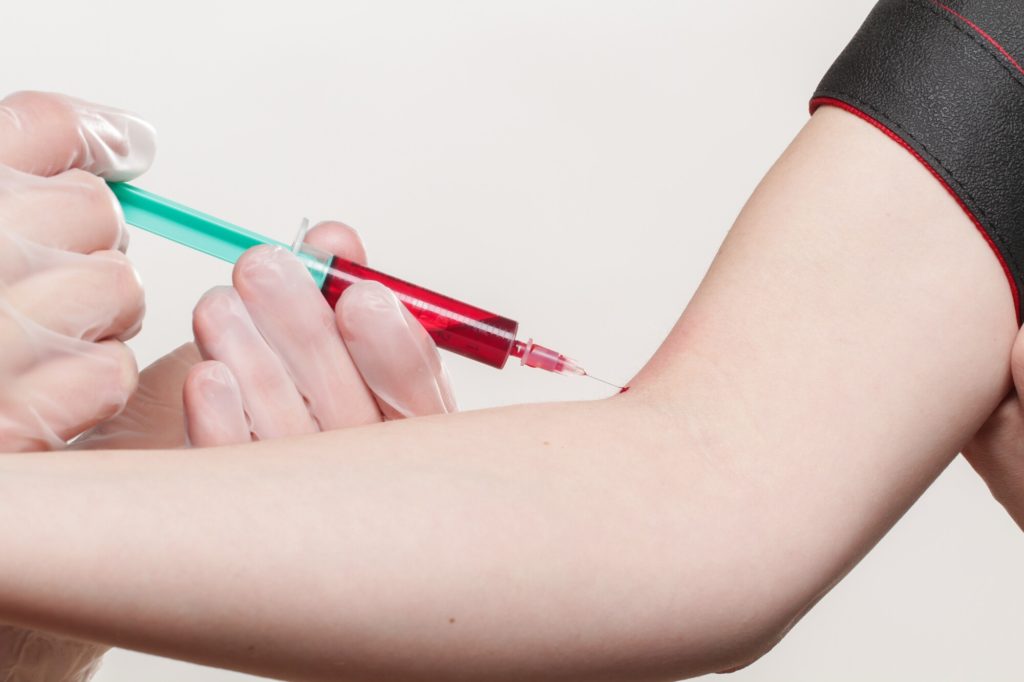 How Does the Blood Draw Process Work?