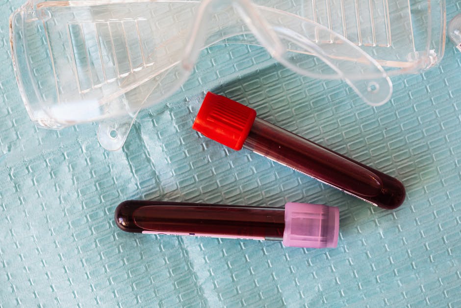 What You Need to Know About Fasting for a Blood Test
