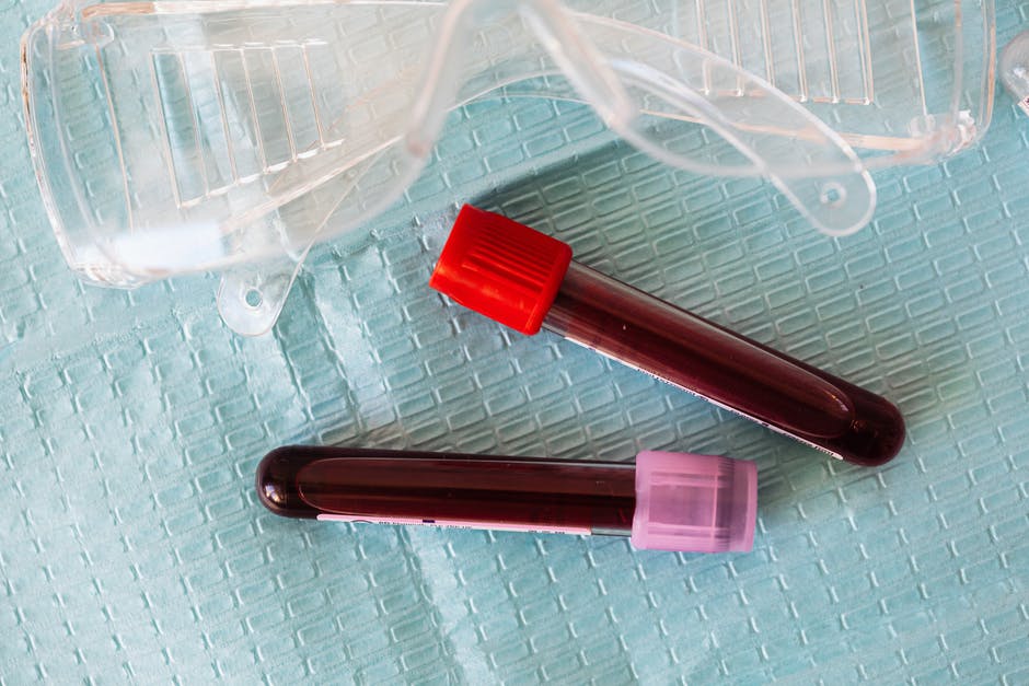 Can You Take Your Medication When Fasting For A Blood Test