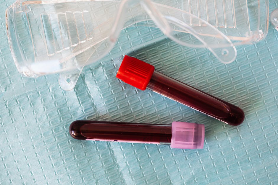 What You Need To Know About Fasting For A Blood Test Precision Labs