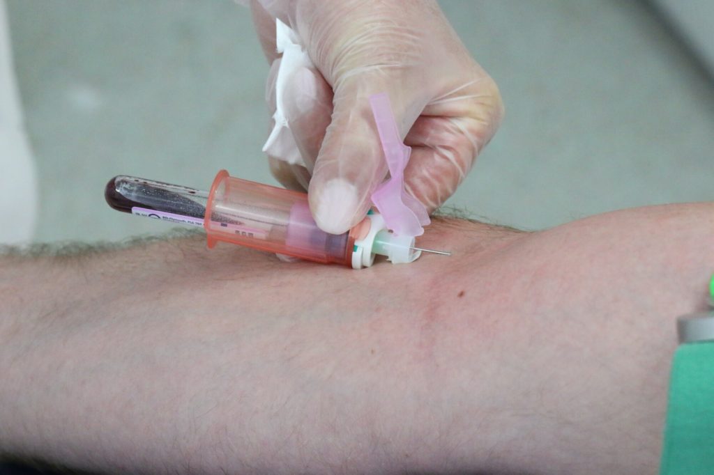 5 Benefits of Hiring a Mobile Phlebotomist