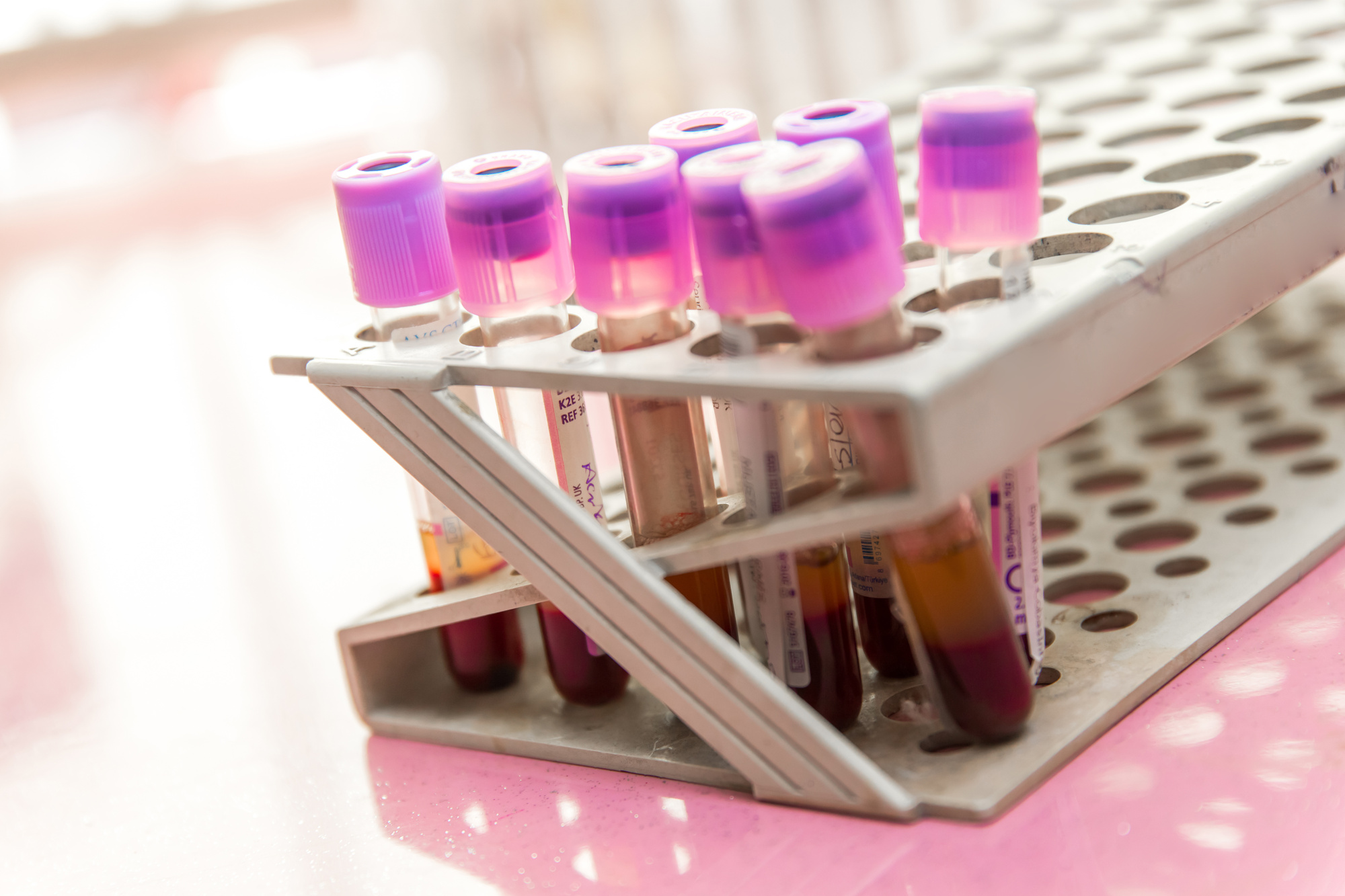 What Should You Know About a Blood Enzyme Test? Precision Labs