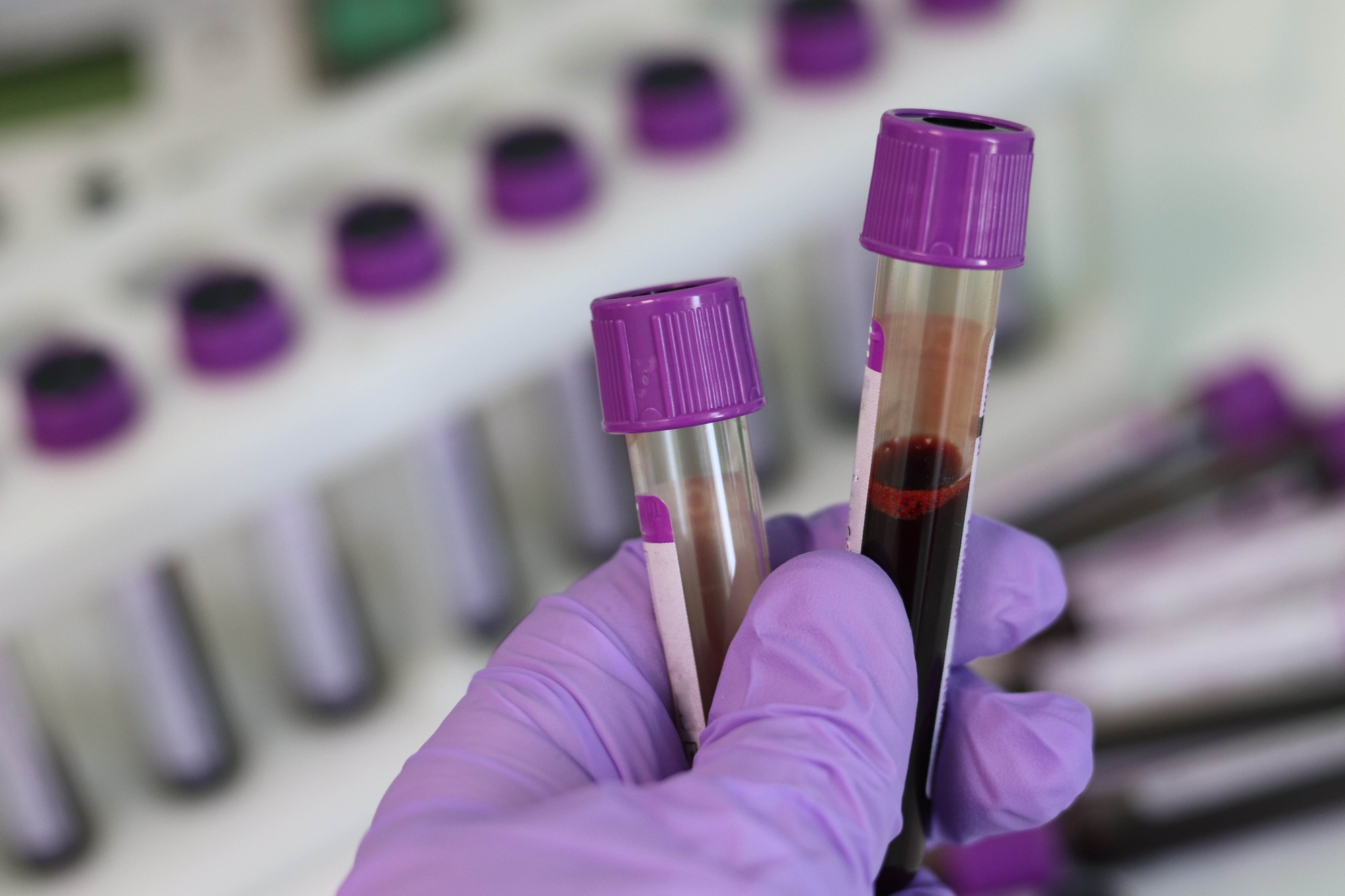 5 Benefits of AtHome Blood Tests Precision Labs