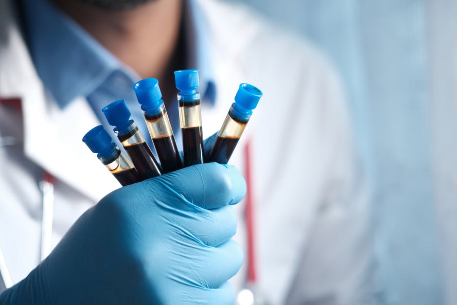 Common Blood Tests to Order for New Patients
