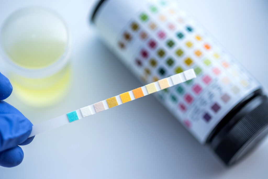 What to Know Before Ordering a Home Creatinine Test