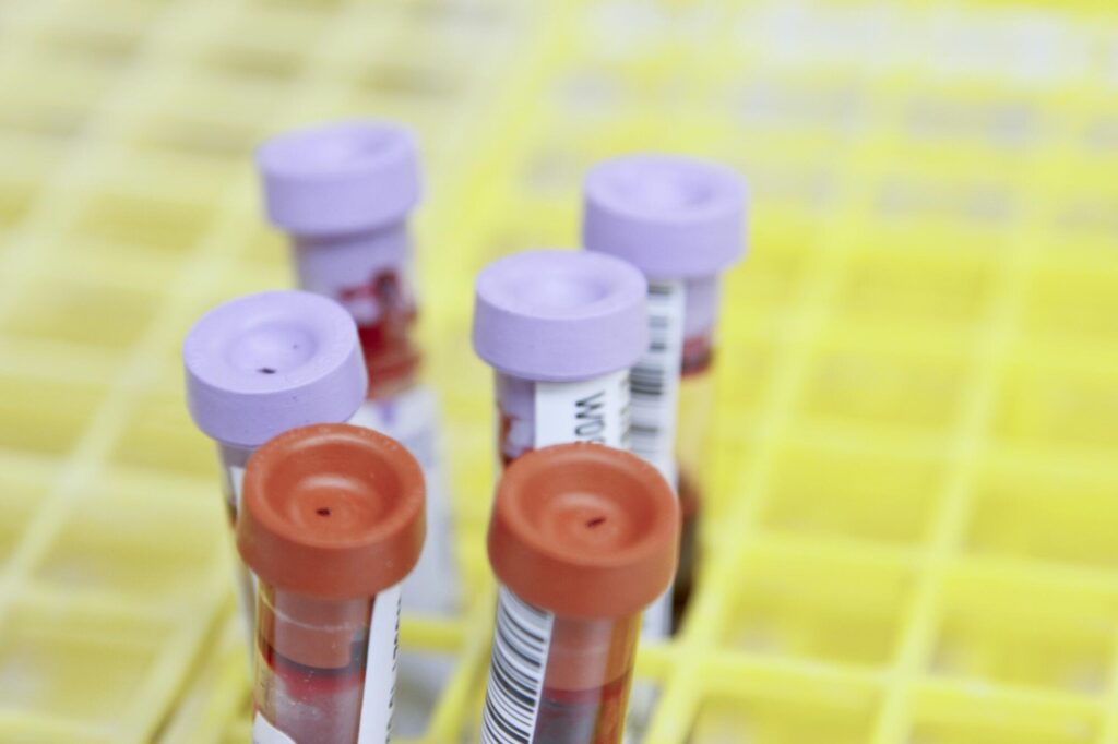 Routine Blood Tests and HIV: What You Need to Know