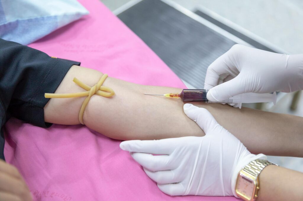 MPV Blood Test: Unveil Hidden Health Insights and Benefits