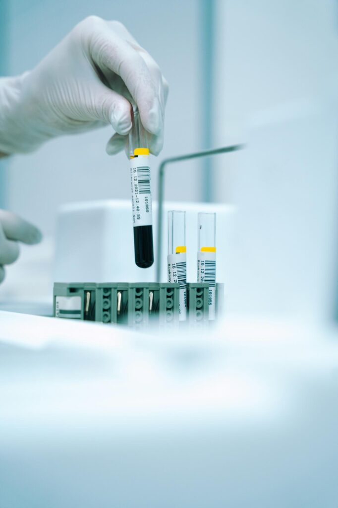 Allergy Blood Tests: What You Need to Know