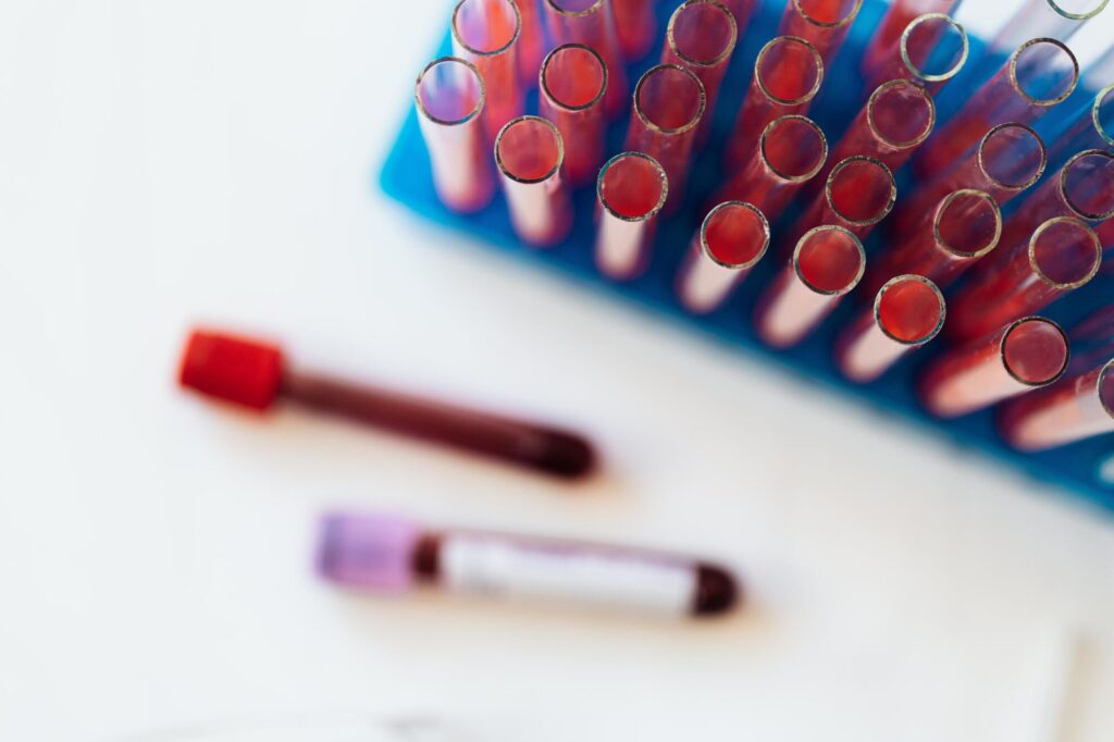 How to Prepare for Your Next Blood Draw Without Triggering False Spikes