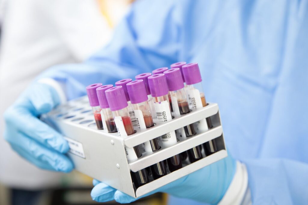 How to Prevent Hair and Nail Supplements From Skewing Your Lab Results